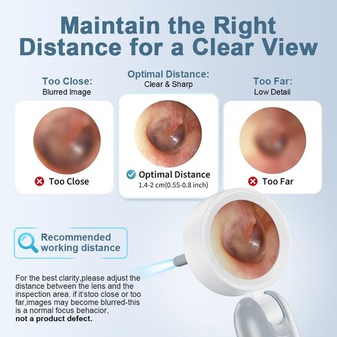 Otoscope Ear Camera with Light, 1.4" Screen 1080P HD Ear Scope, 12 Silicone Specula Tips, Photo & Video Recording, Type-C Rechargeable, Ear Cleaning Camera for Adult Kid and Pet in Kuwait