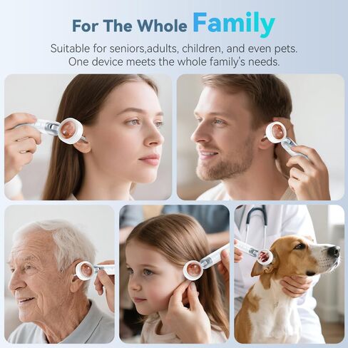 Otoscope Ear Camera with Light, 1.4" Screen 1080P HD Ear Scope, 12 Silicone Specula Tips, Photo & Video Recording, Type-C Rechargeable, Ear Cleaning Camera for Adult Kid and Pet in Kuwait