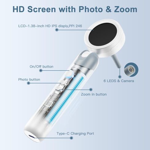 Otoscope Ear Camera with Light, 1.4" Screen 1080P HD Ear Scope, 12 Silicone Specula Tips, Photo & Video Recording, Type-C Rechargeable, Ear Cleaning Camera for Adult Kid and Pet in Kuwait