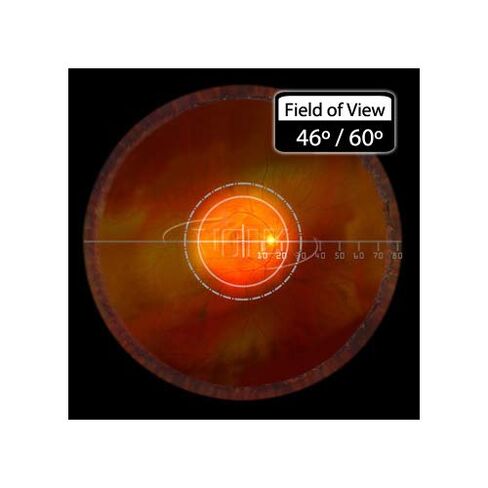 عدسة فولك البصرية 20D الكلاسيكية غير المباشرة للعيون - أزرق in Kuwait