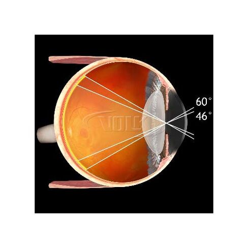عدسة فولك البصرية 20D الكلاسيكية غير المباشرة للعيون - أزرق in Kuwait