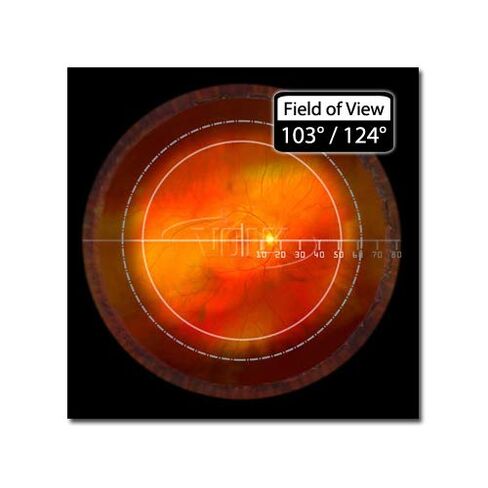 عدسة المصباح الشقي البصري الرقمي واسع النطاق وغير المباشر من فولك - أزرق in Kuwait