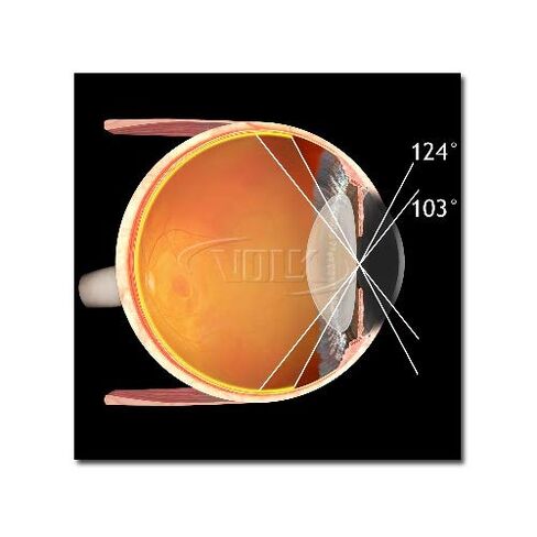 عدسة المصباح الشقي البصري الرقمي واسع النطاق وغير المباشر من فولك - أزرق in Kuwait
