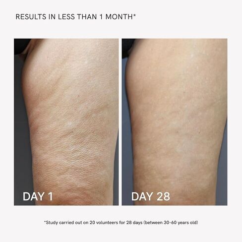 MASDERM - Gel for RF Machines, Firming and Hydrating Body Gel 1000 ml, Professional and Home Use, Improves Skin Elasticity, Hydration and Firmness in Saudi Arabia