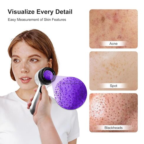 منظار الجلد المكبر 30x مع LED، محلل الجلد المحمول القابل لإعادة الشحن، 4 أوضاع إضاءة وعدسة عالية الوضوح لمراقبة الجلد وفروة الرأس وبصيلات الشعر in Kuwait