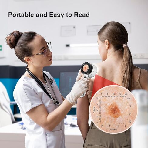 منظار الجلد المكبر 30x مع LED، محلل الجلد المحمول القابل لإعادة الشحن، 4 أوضاع إضاءة وعدسة عالية الوضوح لمراقبة الجلد وفروة الرأس وبصيلات الشعر in Kuwait