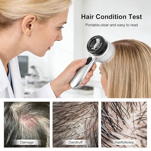 منظار الجلد المكبر 30x مع LED، محلل الجلد المحمول القابل لإعادة الشحن، 4 أوضاع إضاءة وعدسة عالية الوضوح لمراقبة الجلد وفروة الرأس وبصيلات الشعر in Kuwait