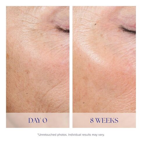 iS CLINICAL Active Peel System, two-step gentle at-home peel system for face Exfoliation in Kuwait