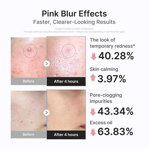 medicube 3H Overnight Drying Lotion | Targeted Spot Care for Troubled & Oily-Prone Skin | Calming & Soothing Care with Calamine, Centella & Tea Tree | Korean Skincare 20ml, 0.67 fl. oz. in Kuwait