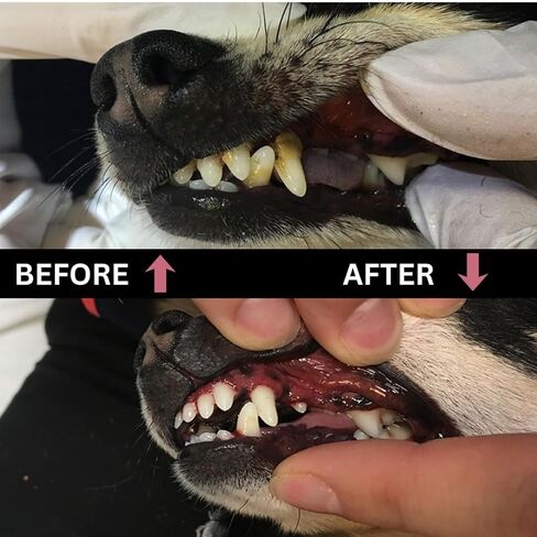 أداة مكشطة جير الأسنان من بروماكس - مزيل البلاك من الفولاذ المقاوم للصدأ لتنظيف الأسنان - أداة نظافة الفم قطعة واحدة in Kuwait