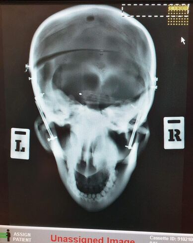 علامات الأشعة السينية مع حزام محمول للتصوير الشعاعي، أقلام تحديد راديوباك L وR لمصور الأشعة مع مشبك بنمط Forget-Me-Not متعدد الألوان مع بوبرسات معدنية in Kuwait