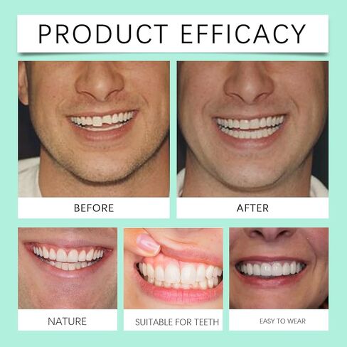 قشور سيليكون ناعمة لأطقم الأسنان، علوية وسفلية، ملائمة حسب الطلب ومريحة، سهلة الاستخدام، قابلة لإعادة الاستخدام، ابتسامة خالية من العيوب in Kuwait