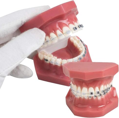 Teeth Orthodontics Dental Demonstration Model, Teach Study Tools with Metal and Ceramic Stand in Saudi Arabia