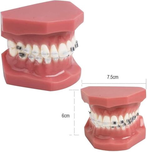 Teeth Orthodontics Dental Demonstration Model, Teach Study Tools with Metal and Ceramic Stand in Saudi Arabia