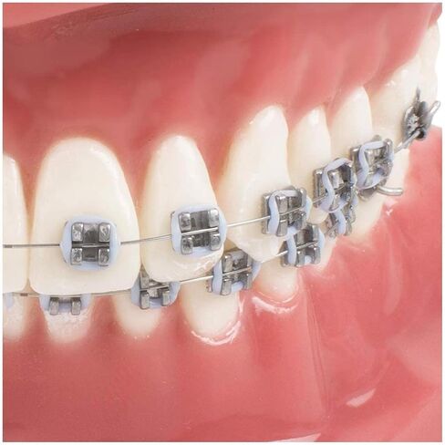 Teeth Orthodontics Dental Demonstration Model, Teach Study Tools with Metal and Ceramic Stand in Saudi Arabia
