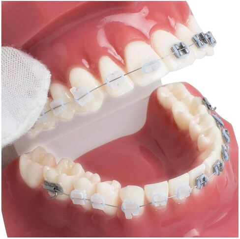 Teeth Orthodontics Dental Demonstration Model, Teach Study Tools with Metal and Ceramic Stand in Saudi Arabia