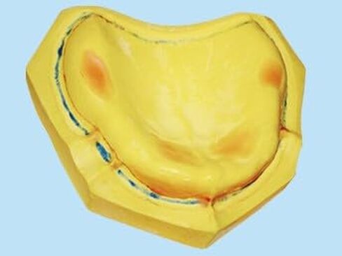 Dental Creations, Ltd. - Wonder Light Cure Tray in Kuwait