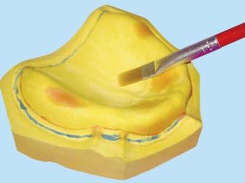 Dental Creations, Ltd. - Wonder Light Cure Tray in Kuwait