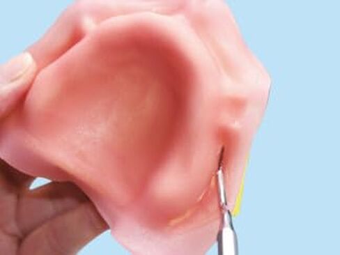 Dental Creations, Ltd. - Wonder Light Cure Tray in Kuwait