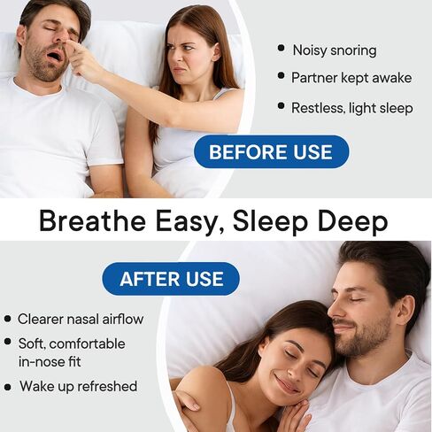 Anti Snoring Devices, Snoring Solution with Adjustable Snore Stopper, 3-Gear Fit, Improves Airflow, Reusable – 4 Pack in Kuwait