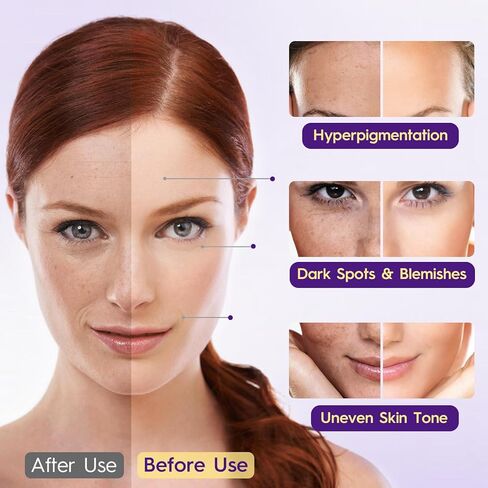 مكمل الجلوتاثيون - تركيبة تفتيح البشرة مع فيتامين C والنياسيناميد ومستخلص عرق السوس والكولاجين وحمض الهيالورونيك - لإشراق البشرة وإشراقها وترطيبها - 180 قرصًا in Kuwait