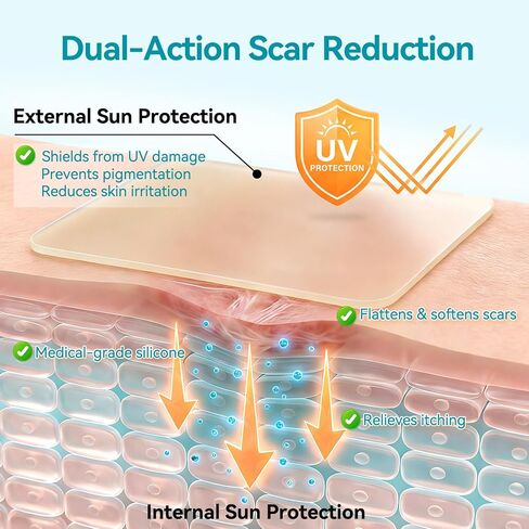 Dimora UPF50+ Silicone Scar Sheets with UV Protection Reusable Sheets to Soften, Flatten Fade Scars, Reduce Redness for Surgical, C-Section, Burn, Keloid, and Hypertrophic Scars (1.6"x78.7" Roll) in Kuwait