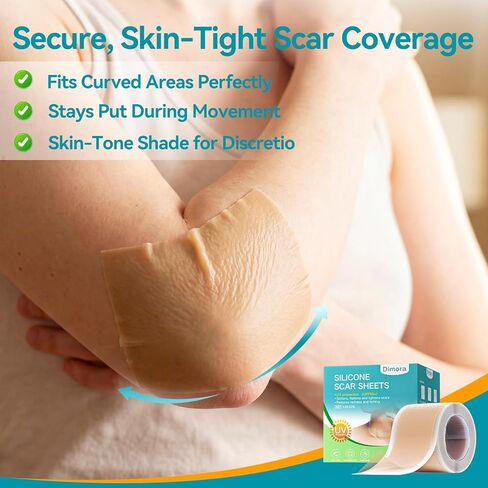 Dimora UPF50+ Silicone Scar Sheets with UV Protection Reusable Sheets to Soften, Flatten Fade Scars, Reduce Redness for Surgical, C-Section, Burn, Keloid, and Hypertrophic Scars (1.6"x78.7" Roll) in Kuwait