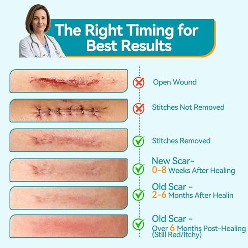 Dimora UPF50+ Silicone Scar Sheets with UV Protection Reusable Sheets to Soften, Flatten Fade Scars, Reduce Redness for Surgical, C-Section, Burn, Keloid, and Hypertrophic Scars (1.6"x78.7" Roll) in Kuwait