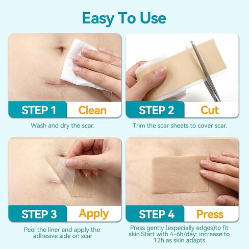 Dimora UPF50+ Silicone Scar Sheets with UV Protection Reusable Sheets to Soften, Flatten Fade Scars, Reduce Redness for Surgical, C-Section, Burn, Keloid, and Hypertrophic Scars (1.6"x78.7" Roll) in Kuwait