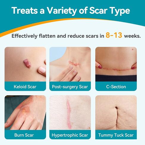 Dimora UPF50+ Silicone Scar Sheets with UV Protection Reusable Sheets to Soften, Flatten Fade Scars, Reduce Redness for Surgical, C-Section, Burn, Keloid, and Hypertrophic Scars (1.6"x78.7" Roll) in Kuwait