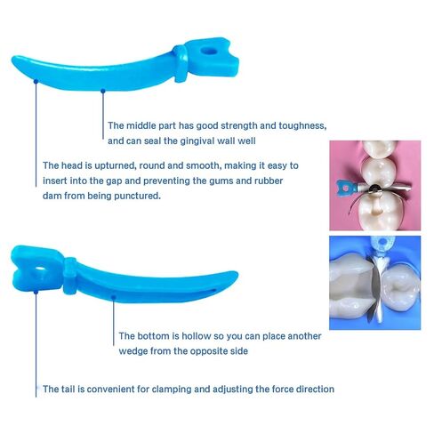 Dental Matrix Holder Clamp Tweezers, Dental Tulwar Wedges Set, 1pcs Matrices Tweezer Forceps+W5 Wedge 72pcs (Wedges) in Saudi Arabia