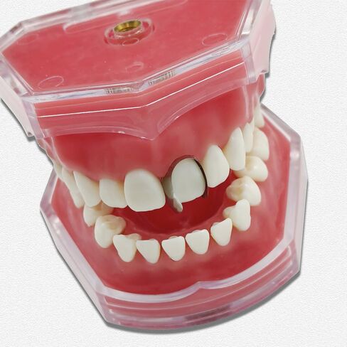 30pcs/Pack Dental Twin Anterior Matrices Large Small Proximal Anterior StripsMatrix Systems, Dental Restoration Materials in Kuwait