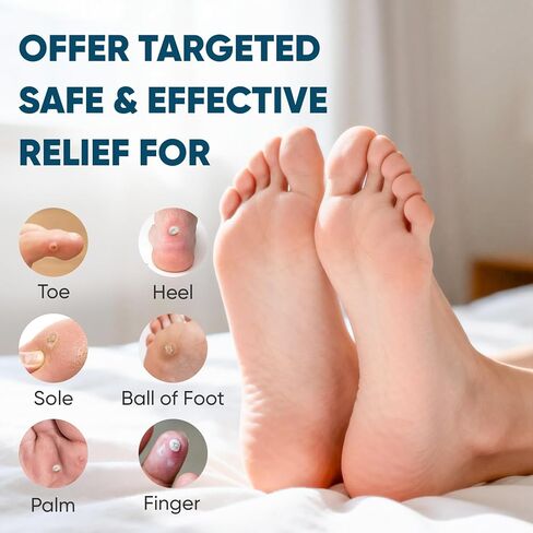 وسادات إزالة الذرة 48P للقدمين وأصابع القدم، قوة إضافية 40% رقع طبية من حمض الساليسيليك، علاج فعال لمسامير القدم الصغيرة والجلد الميت in Kuwait