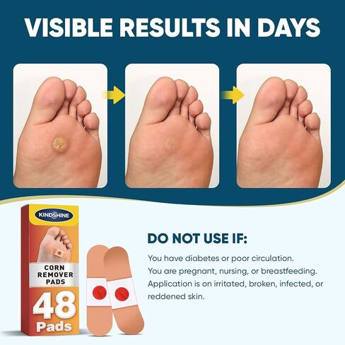 وسادات إزالة الذرة 48P للقدمين وأصابع القدم، قوة إضافية 40% رقع طبية من حمض الساليسيليك، علاج فعال لمسامير القدم الصغيرة والجلد الميت in Kuwait