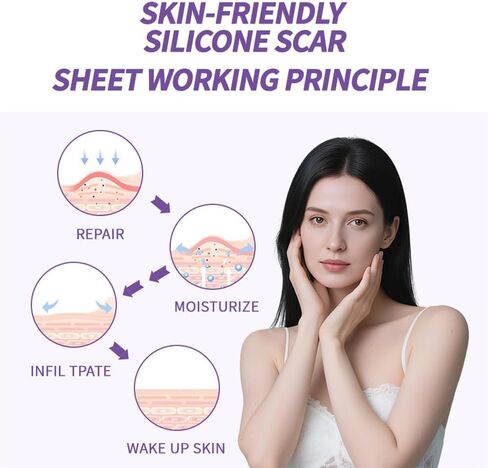 أوراق الندبات المصنوعة من السيليكون من الدرجة الطبية، (لفة الندبات 1.6 بوصة × 60 بوصة - 1.5 متر) - شرائط شريط إزالة الندبات القابلة لإعادة الاستخدام للعمليات الجراحية، القسم القيصري، شد البطن، إزالة نتوءات الجدرة (طبيعية) in Kuwait