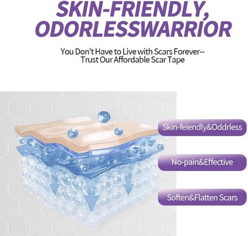 أوراق الندبات المصنوعة من السيليكون من الدرجة الطبية، (لفة الندبات 1.6 بوصة × 60 بوصة - 1.5 متر) - شرائط شريط إزالة الندبات القابلة لإعادة الاستخدام للعمليات الجراحية، القسم القيصري، شد البطن، إزالة نتوءات الجدرة (طبيعية) in Kuwait