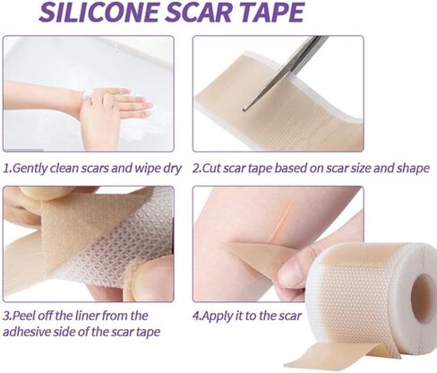 أوراق الندبات المصنوعة من السيليكون من الدرجة الطبية، (لفة الندبات 1.6 بوصة × 60 بوصة - 1.5 متر) - شرائط شريط إزالة الندبات القابلة لإعادة الاستخدام للعمليات الجراحية، القسم القيصري، شد البطن، إزالة نتوءات الجدرة (طبيعية) in Kuwait