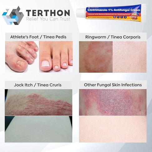 Antifungal Cream Clotrimazole 1%: Treatment for Ringworm, Jock Itch, Athlete’s Foot & Skin Fungal Infections – Relieves Itching, Burning, Cracking & Redness – Natural Botanicals Enhanced (30g) in Kuwait