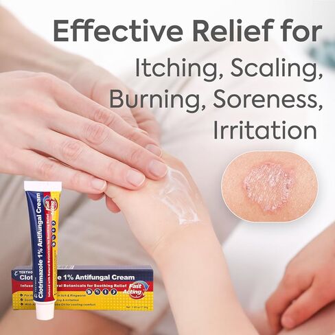 Antifungal Cream Clotrimazole 1%: Treatment for Ringworm, Jock Itch, Athlete’s Foot & Skin Fungal Infections – Relieves Itching, Burning, Cracking & Redness – Natural Botanicals Enhanced (30g) in Kuwait