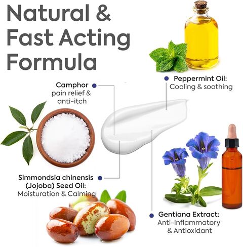 Antifungal Cream Clotrimazole 1%: Treatment for Ringworm, Jock Itch, Athlete’s Foot & Skin Fungal Infections – Relieves Itching, Burning, Cracking & Redness – Natural Botanicals Enhanced (30g) in Kuwait