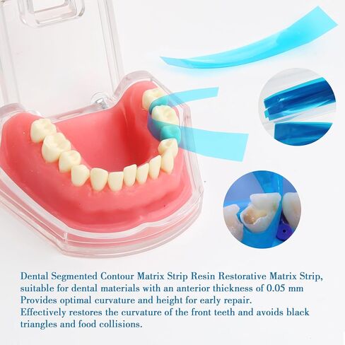 Dental Contoured Anterior Matrix Bands Resin Forming Strip Matrix Strips Length Blue Transparent Contoured Anterior Matrix M8 1.0 50 Pcs/Box in Kuwait