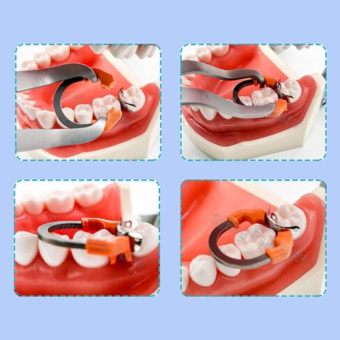 Dental Sectional Matrix System, D3 Dental Metal Matrices Band,R7 Dental Metal Matrices Clamp Ring, Tooth Repair Kits (D3-Set) in Saudi Arabia