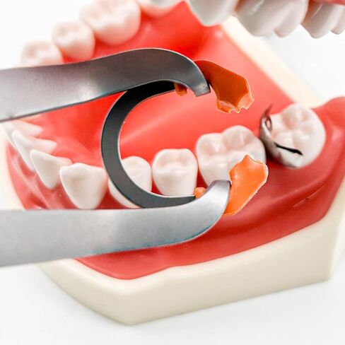 Dental Sectional Matrix System, D3 Dental Metal Matrices Band,R7 Dental Metal Matrices Clamp Ring, Tooth Repair Kits (D3-Set) in Saudi Arabia
