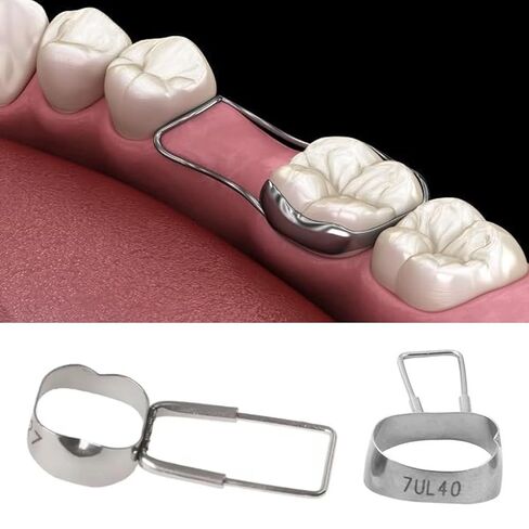 Dental Space Maintainer Preformed Molar Orthodontic Band 32#-41# Gap Retainer Dentistry Materials in Saudi Arabia