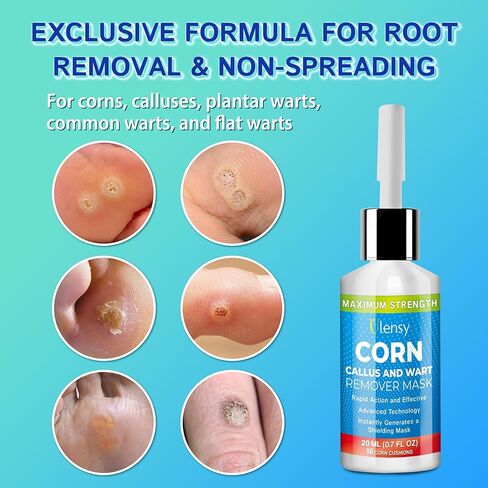 سائل مزيل الذرة لأصابع القدم: 20 مل حمض الساليسيليك لإزالة ثآليل مسامير القدم في العمل بالمنزل - آمن للأطفال والمراهقين والكبار وكبار السن والرياضيين والعدائين والعمال والرجال والنساء in Kuwait