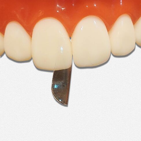 30pcs/Pack Dental Matrix Bands Anterior Matrix Strip Metal Matrices Transparent Bow Anterior Matrices Sectional Contoured Matrix System in Kuwait