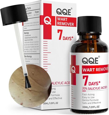 سائل مزيل الثآليل بحمض الساليسيليك بنسبة 20%، مزيل الثآليل بدون ألم للأخمصي، الشائع، الثآليل المسطحة، ذرة القدم لأجزاء متعددة من الجسم (عبوة من قطعة واحدة) in Kuwait