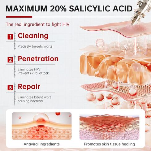 سائل مزيل الثآليل بحمض الساليسيليك بنسبة 20%، مزيل الثآليل بدون ألم للأخمصي، الشائع، الثآليل المسطحة، ذرة القدم لأجزاء متعددة من الجسم (عبوة من قطعة واحدة) in Kuwait