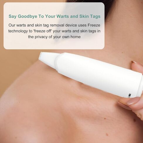 Skin Clinic Freeze Point for Warts and Skin Tags, 1 Warts and SkinTag Removal Kit About 10 Treatments, Safe Home Use Cryogenic Freeze-Off Kit, Wart and SkinTags Removal in 7-14 Days 01271740 in Kuwait
