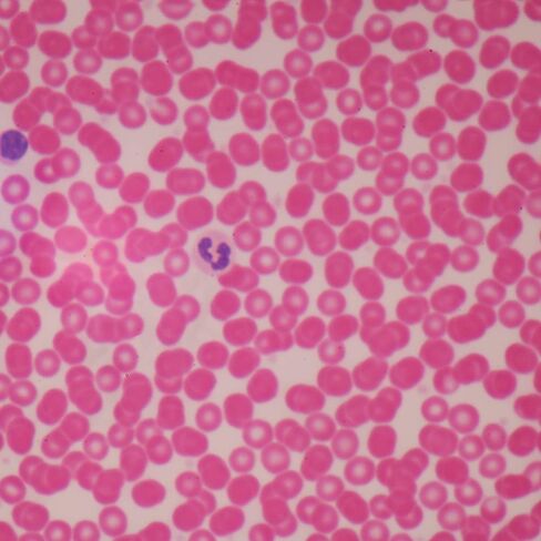 Human Male Blood Film Slide, Smear in Saudi Arabia